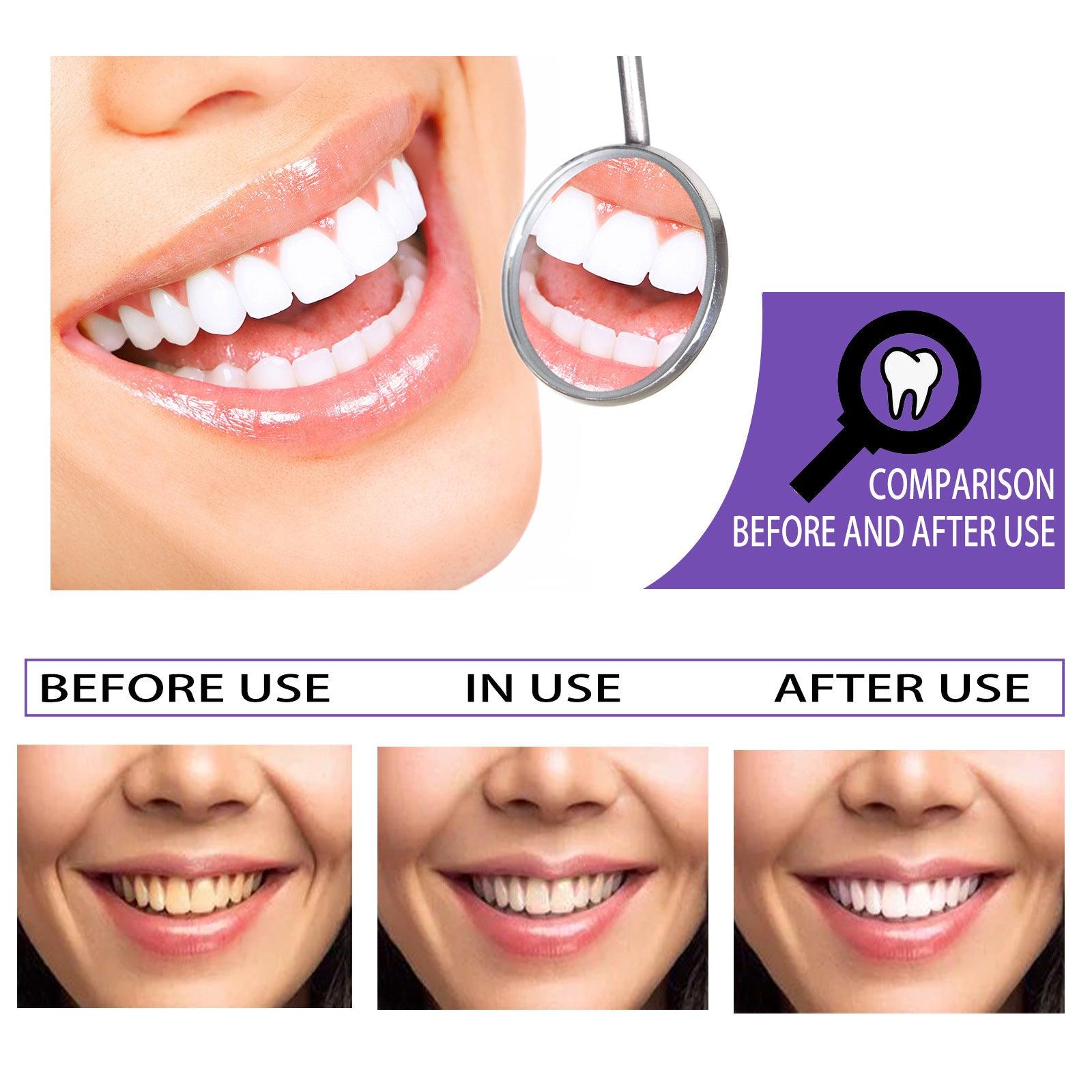 Teeth Whitening Toothpaste Whitening Teeth Removal - lotsofthingshere