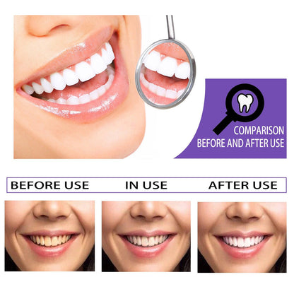 Teeth Whitening Toothpaste Whitening Teeth Removal - lotsofthingshere