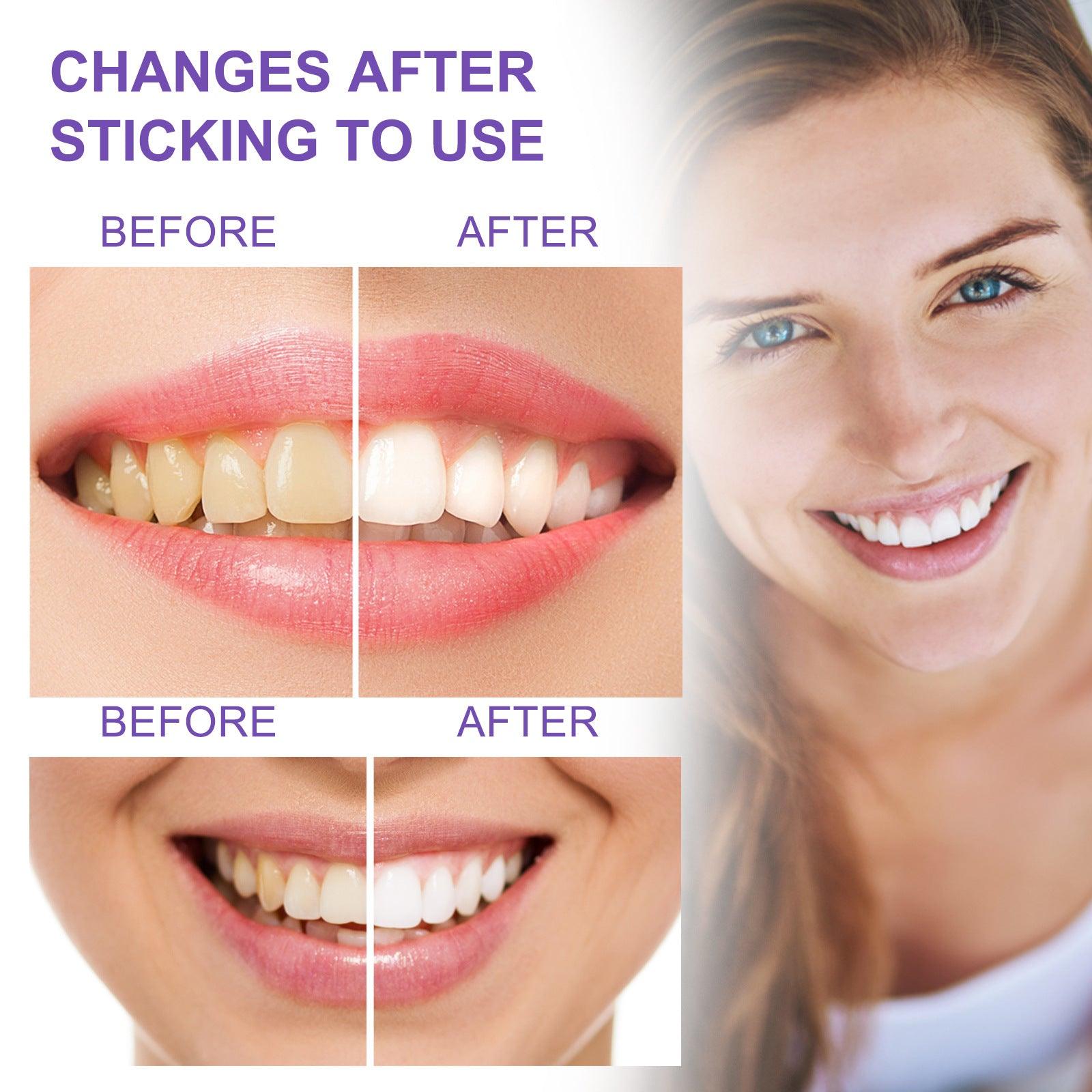 Teeth Whitening Toothpaste Whitening Teeth Removal - lotsofthingshere